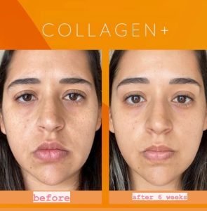 Our-blend-of-Antioxidants_-Ceramides-and-Collagen-Peptides-offers___Helps-support-collagen-and-elastin-formation__Supports-skin-hydration-and-healthy-moistu-295x300-1.jpg